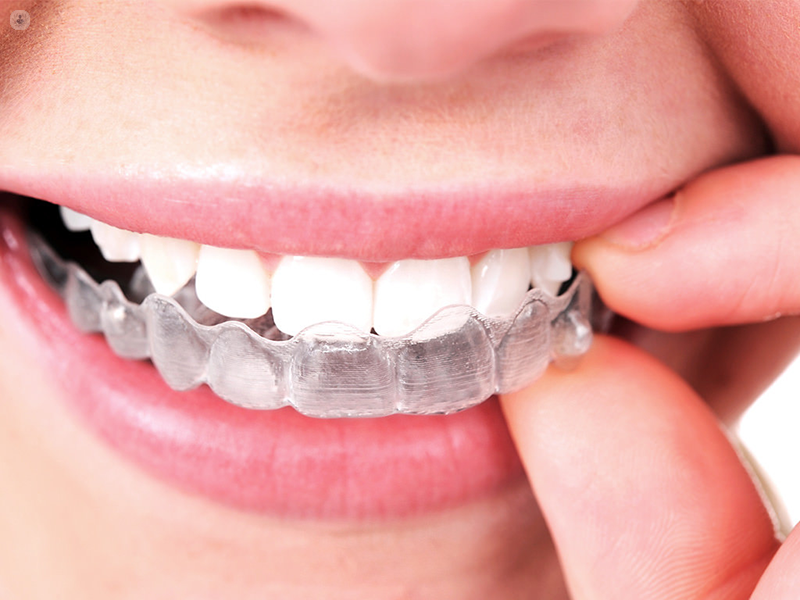 skaffa en invisalign tandställning